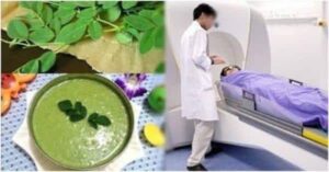 Loại rau phá hủy hơn 90% tế bào UT trong vòng 48h mà người Việt cứ ngỡ là rau dại mọc đầy đường