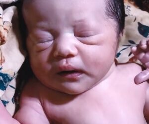 Con sơ sinh chào đời 7 ngày vẫn chưa mở mắt, tưởng con gặp vấn đề mẹ liền đưa đến bệnh viện, kết quả không ngờ
