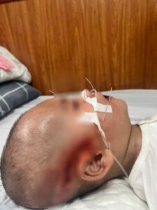 Bé trai mầm non nhập viện cấp cứu sau khi thét 1 tiếng trên lớp, bố mẹ bật khóc khi biết lý do