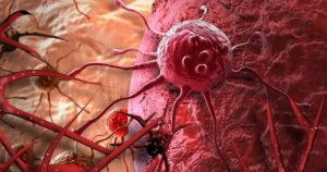 Tế bào UT bị tiêu diệt bằng ly nước ép trong 42 ngày đã thành công ngoài mong đợi, cả thế giới đang ăn mừng