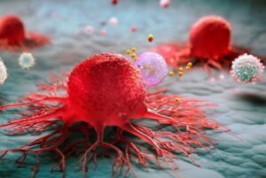 Nhật Bản có tỉ lệ qua đời vì UT rất thấp: 3 món họ ít ăn, chúng ta lại ăn thật nhiều