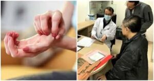 Ngứa ở 7 vị trí là dấu hiệu cảnh báo cơ thể có khối u ác tính, số 3 nhiều người gặp nhất