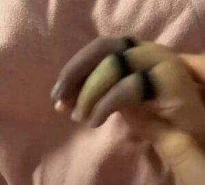 Con ngồi chơi ở phòng khách bỗng khóc rống lên, mẹ phát hoảng thấy tay con 3 màu, bác sĩ cảnh báo