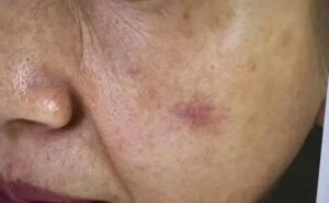 UT gan không gây đau đớn đến khi phát hiện thì đã ở giai đoạn cuối, cảnh báo 3 dấu hiệu cần đi khám gấp