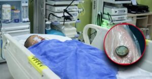 Bé trai 3 tuổi nuốt phải pin cúc áo, mẹ cho uống ngay 1 thìa gia vị, đến bệnh viện bác sĩ khen: “Giỏi lắm”