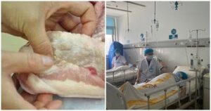 2 bộ phận của lợn chứa rất nhiều tế bào UT: Đừng ăn kẻo ngấm bệnh lúc nào không biết