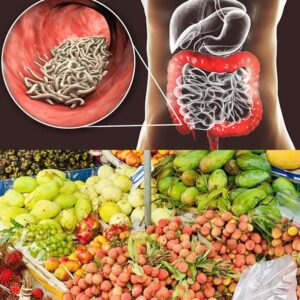 6 loại trái cây chứa nhiều ký sinh trùng nhất mùa hè