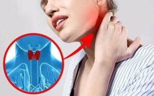 5 dấu hiệu K tuyến giáp mới chớm: Biết sớm chữa là khỏi