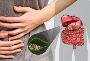 Triệu chứng bệnh sỏi túi mật, cảnh báo biến chứng nặng